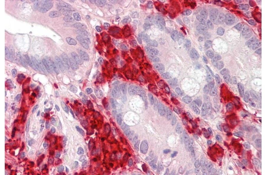 Immunohistochemistry - Anti-TXNDC5 Antibody (A82766) - Antibodies.com