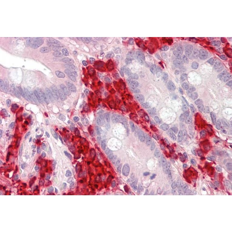 Immunohistochemistry - Anti-TXNDC5 Antibody (A82766) - Antibodies.com