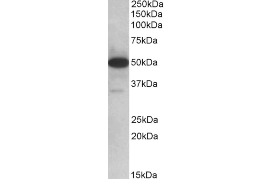 Western Blot - Anti-TXNDC5 Antibody (A82767) - Antibodies.com