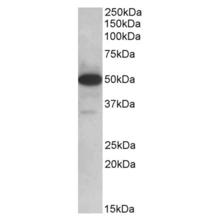 Western Blot - Anti-TXNDC5 Antibody (A82767) - Antibodies.com