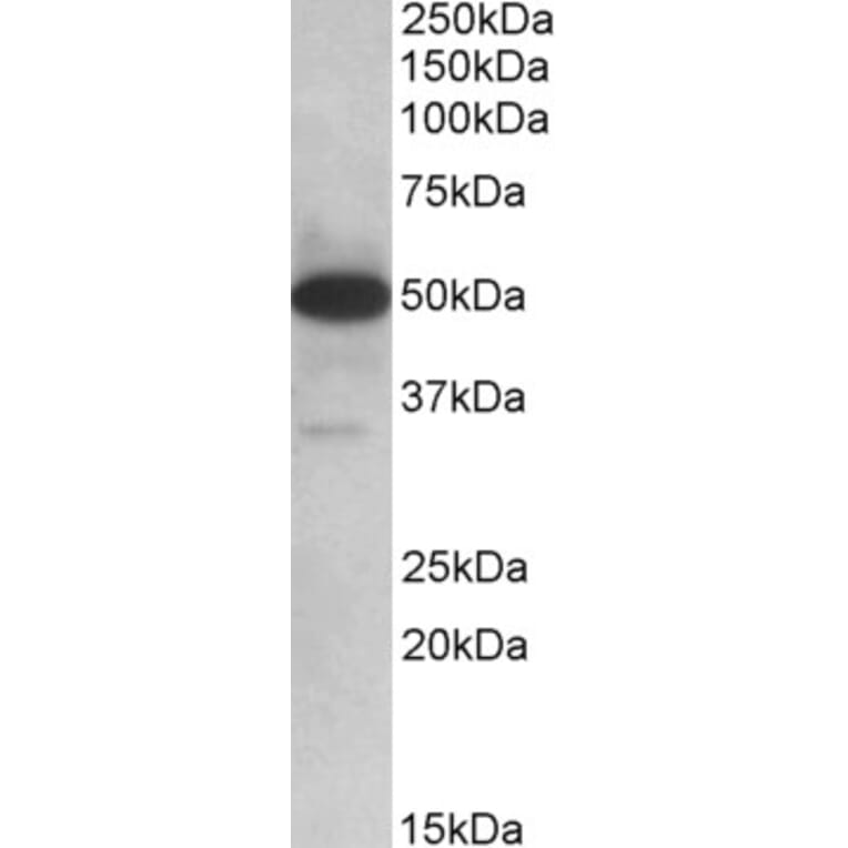 Western Blot - Anti-TXNDC5 Antibody (A82767) - Antibodies.com
