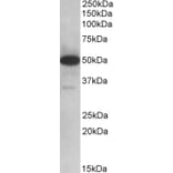 Western Blot - Anti-TXNDC5 Antibody (A82767) - Antibodies.com