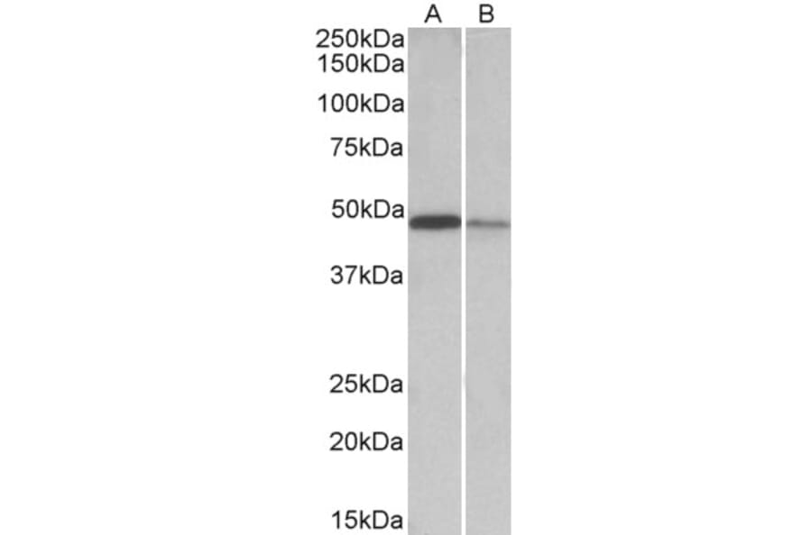 Western Blot - Anti-TXNDC5 Antibody (A82767) - Antibodies.com