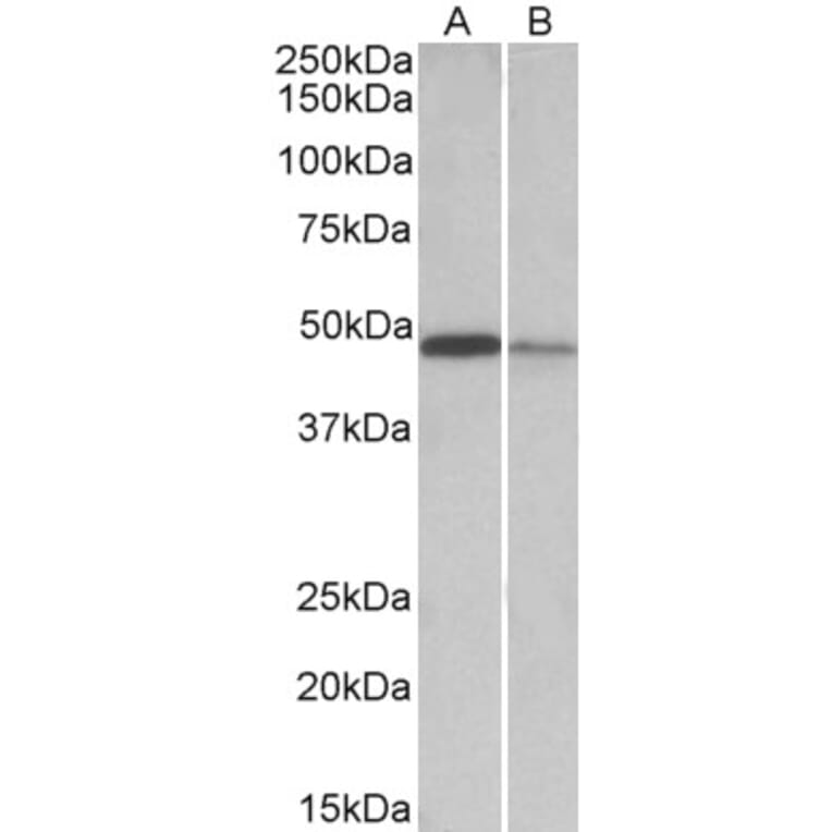 Western Blot - Anti-TXNDC5 Antibody (A82767) - Antibodies.com