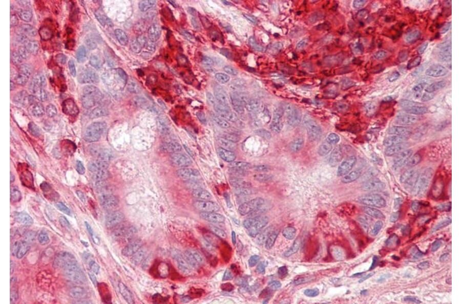 Immunohistochemistry - Anti-TXNDC5 Antibody (A82767) - Antibodies.com