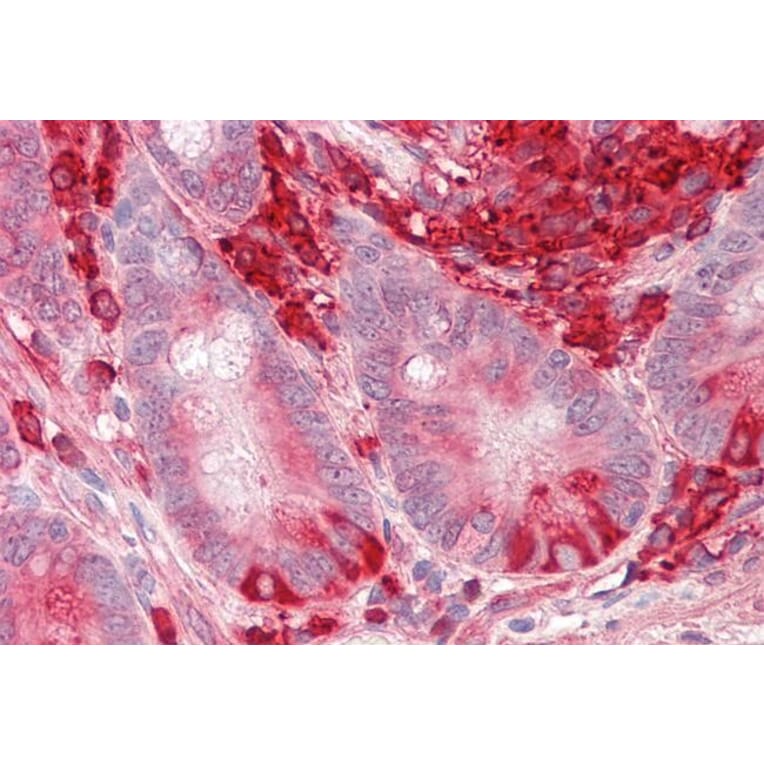 Immunohistochemistry - Anti-TXNDC5 Antibody (A82767) - Antibodies.com