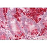 Immunohistochemistry - Anti-TXNDC5 Antibody (A82767) - Antibodies.com