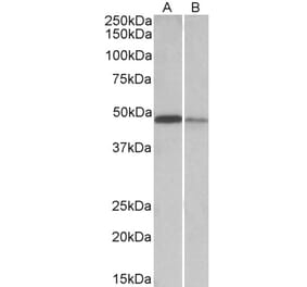 Western Blot - Anti-TXNDC5 Antibody (A82767) - Antibodies.com
