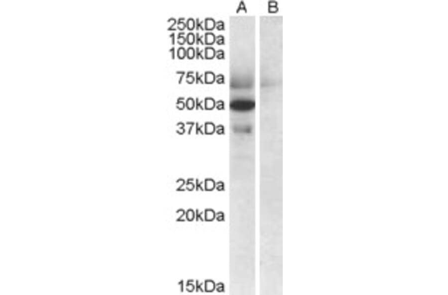 Western Blot - Anti-APOL4 Antibody (A82768) - Antibodies.com