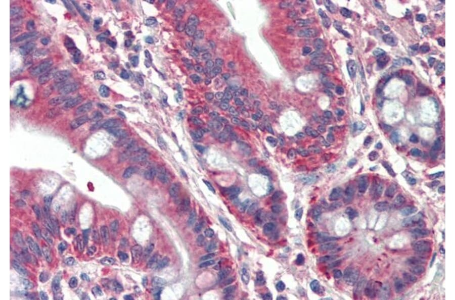 Immunohistochemistry - Anti-RUFY1 Antibody (A82769) - Antibodies.com