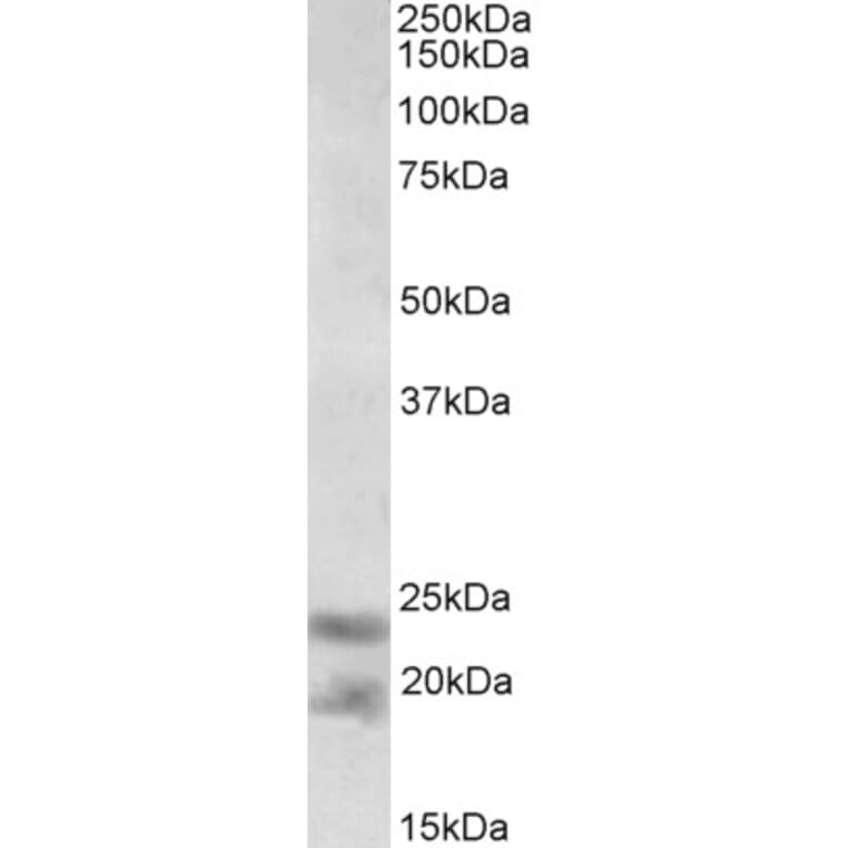 Western Blot - Anti-IL25 Antibody (A82773) - Antibodies.com