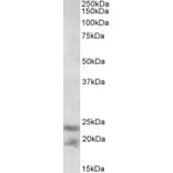 Western Blot - Anti-IL25 Antibody (A82773) - Antibodies.com