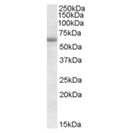 Western Blot - Anti-CDH23 Antibody (A82777) - Antibodies.com