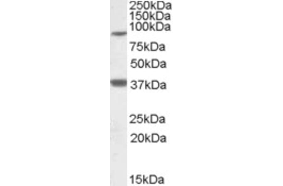 Western Blot - Anti-Ceramide Synthase 1/LAG1 Antibody (A82778) - Antibodies.com