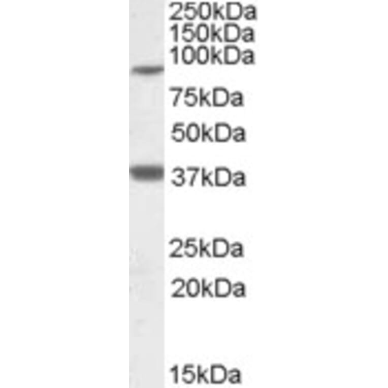 Western Blot - Anti-Ceramide Synthase 1/LAG1 Antibody (A82778) - Antibodies.com