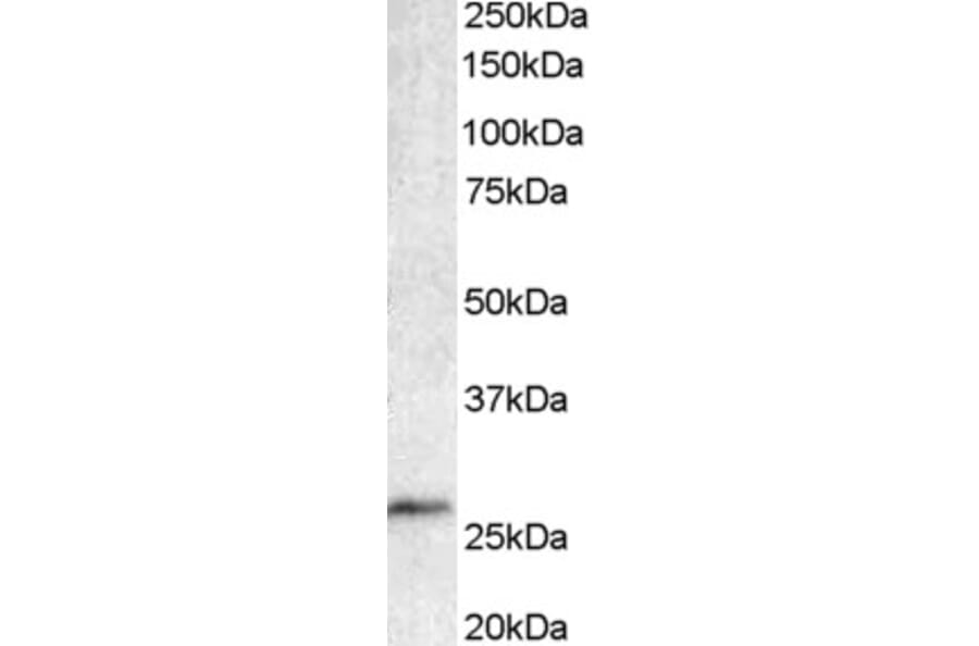 Western Blot - Anti-Bcl 7A Antibody (A82781) - Antibodies.com