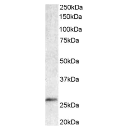 Western Blot - Anti-Bcl 7A Antibody (A82781) - Antibodies.com