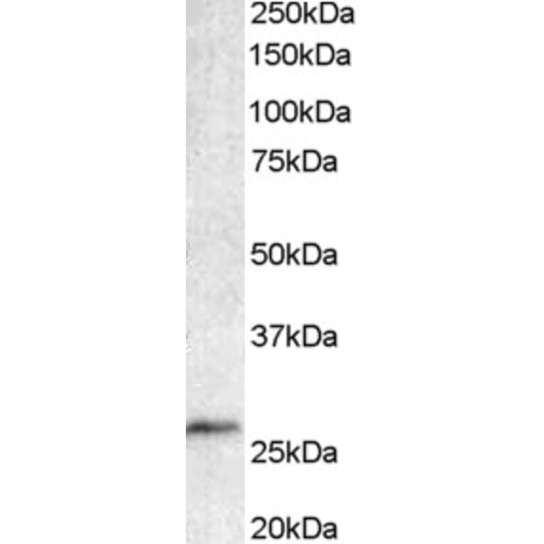 Western Blot - Anti-Bcl 7A Antibody (A82781) - Antibodies.com