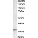 Western Blot - Anti-Bcl 7A Antibody (A82781) - Antibodies.com