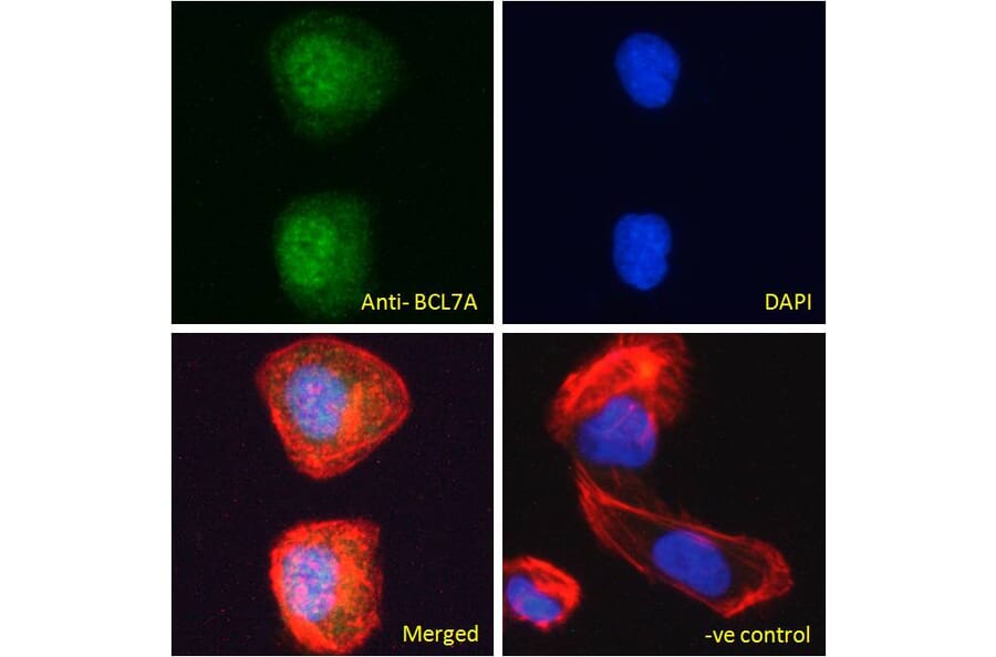 Immunofluorescence - Anti-Bcl 7A Antibody (A82781) - Antibodies.com