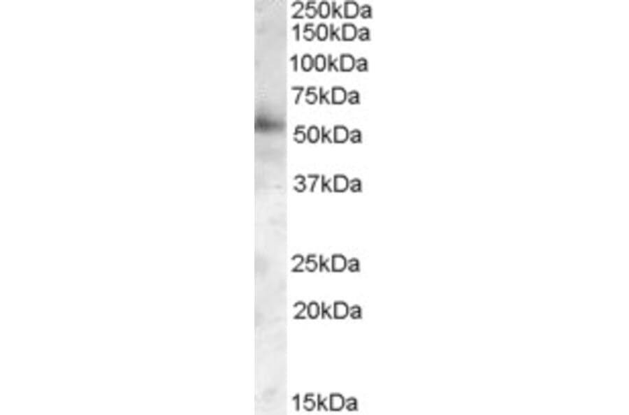 Western Blot - Anti-PIST Antibody (A82782) - Antibodies.com