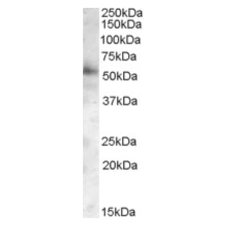 Western Blot - Anti-PIST Antibody (A82782) - Antibodies.com