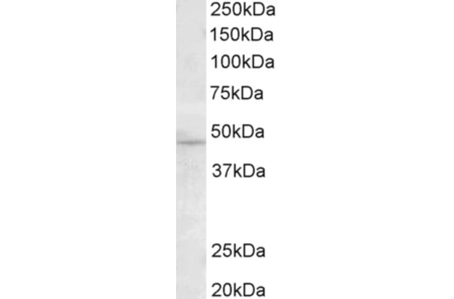 Western Blot - Anti-TMPRSS4 Antibody (A82783) - Antibodies.com