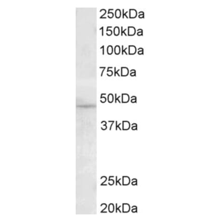 Western Blot - Anti-TMPRSS4 Antibody (A82783) - Antibodies.com