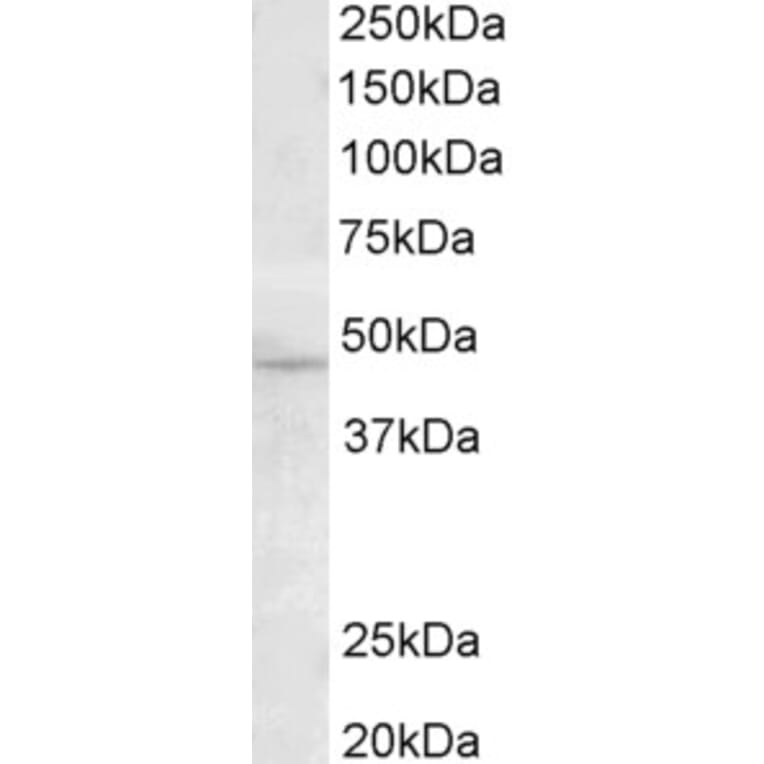 Western Blot - Anti-TMPRSS4 Antibody (A82783) - Antibodies.com