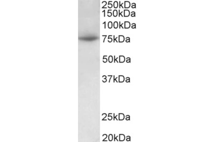 Western Blot - Anti-PRMT7 Antibody (A82785) - Antibodies.com