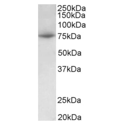 Western Blot - Anti-PRMT7 Antibody (A82785) - Antibodies.com