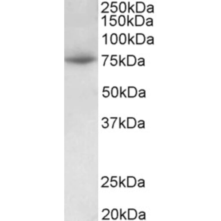 Western Blot - Anti-PRMT7 Antibody (A82785) - Antibodies.com