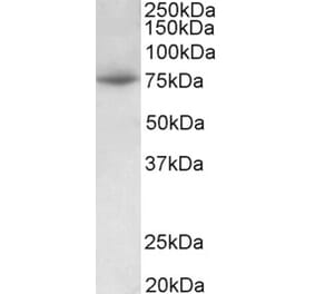 Western Blot - Anti-PRMT7 Antibody (A82785) - Antibodies.com