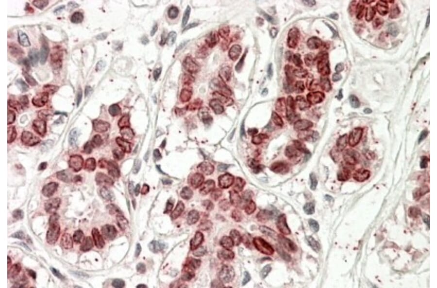 Immunohistochemistry - Anti-UBASH3A Antibody (A82787) - Antibodies.com