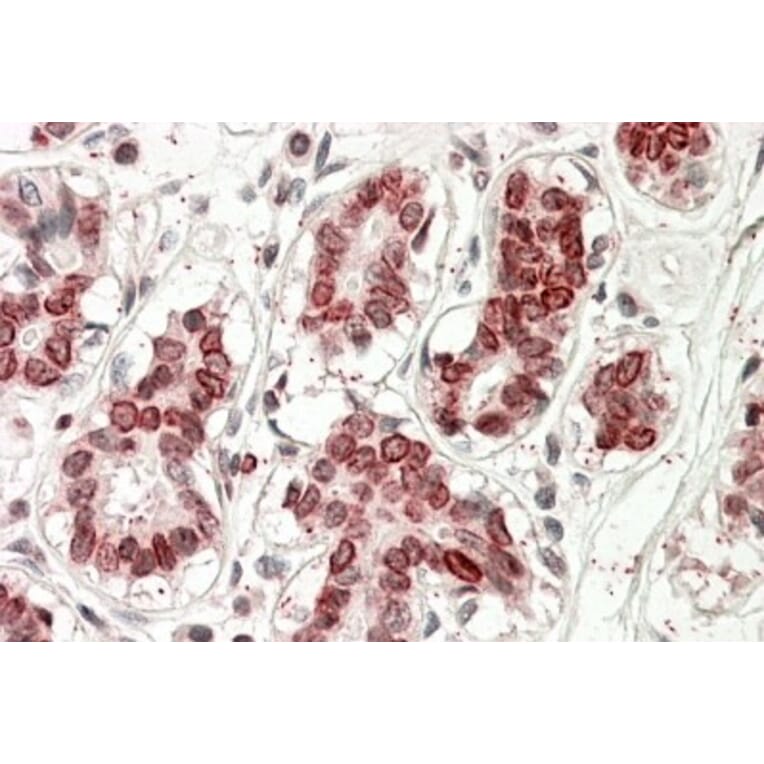 Immunohistochemistry - Anti-UBASH3A Antibody (A82787) - Antibodies.com