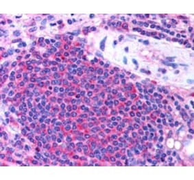 Immunohistochemistry - Anti-UBASH3A Antibody (A82788) - Antibodies.com