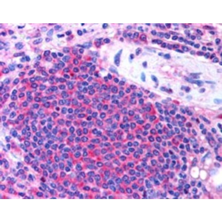 Immunohistochemistry - Anti-UBASH3A Antibody (A82788) - Antibodies.com