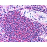 Immunohistochemistry - Anti-UBASH3A Antibody (A82788) - Antibodies.com