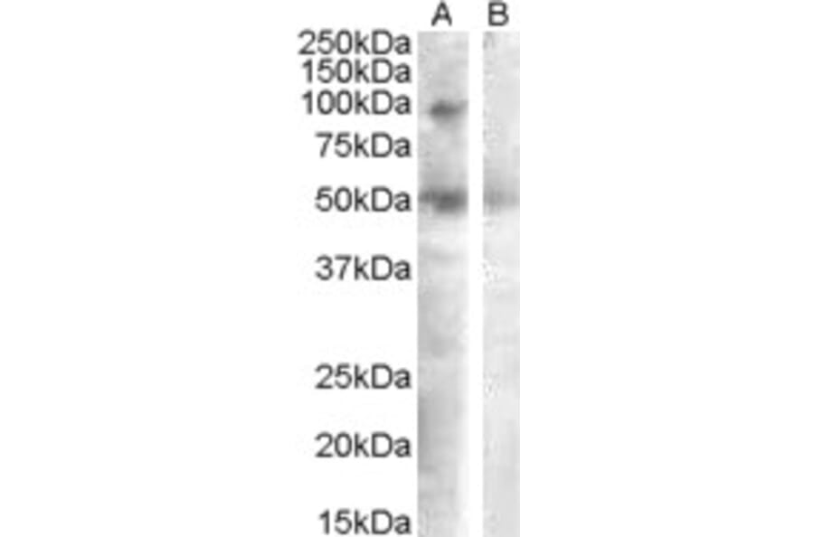 Western Blot - Anti-SULF2 Antibody (A82789) - Antibodies.com