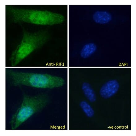 Immunofluorescence - Anti-Rif1 Antibody (A82790) - Antibodies.com