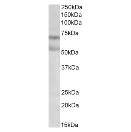 Western Blot - Anti-Cannabinoid Receptor I Antibody (A82794) - Antibodies.com