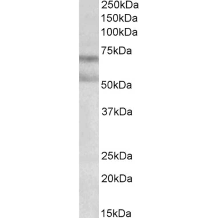 Western Blot - Anti-Cannabinoid Receptor I Antibody (A82794) - Antibodies.com