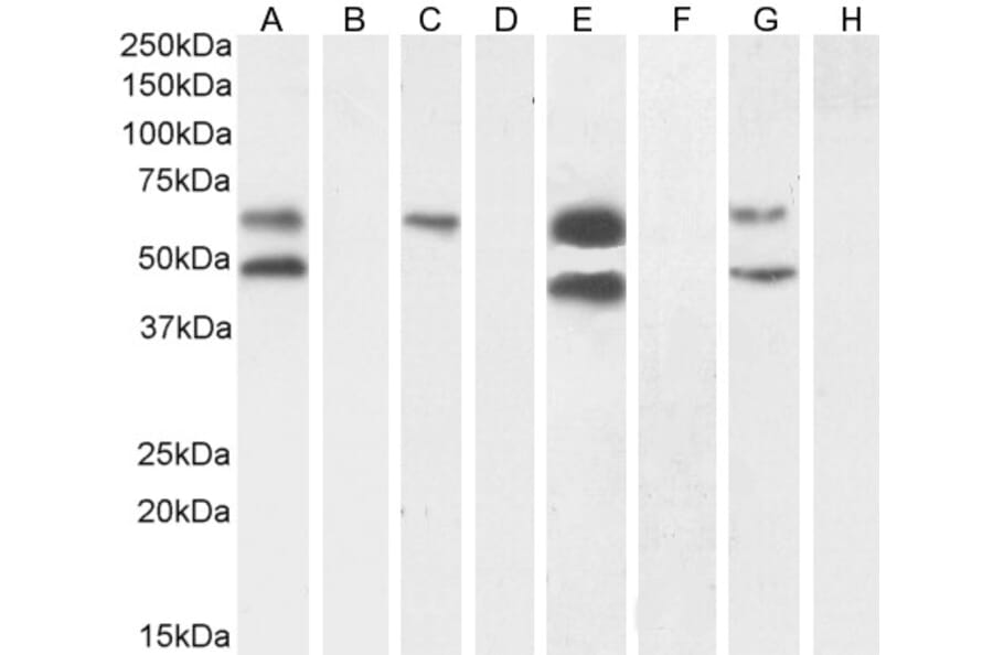 Western Blot - Anti-CAMK2 alpha Antibody (A82795) - Antibodies.com