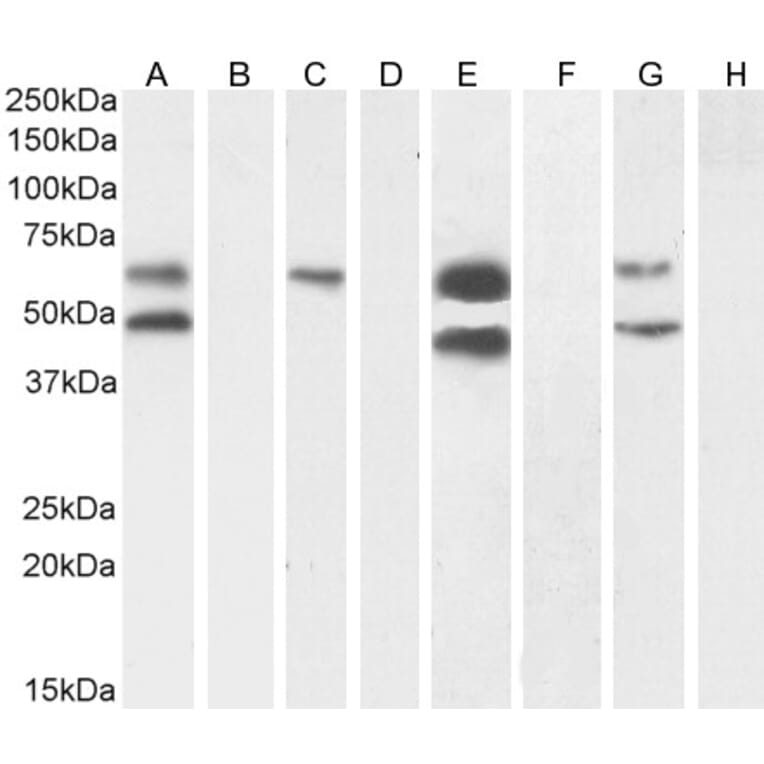Western Blot - Anti-CAMK2 alpha Antibody (A82795) - Antibodies.com