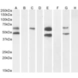 Western Blot - Anti-CAMK2 alpha Antibody (A82795) - Antibodies.com
