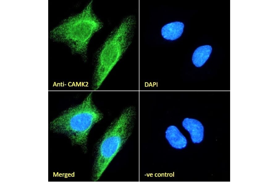 Immunofluorescence - Anti-CAMK2 alpha Antibody (A82795) - Antibodies.com
