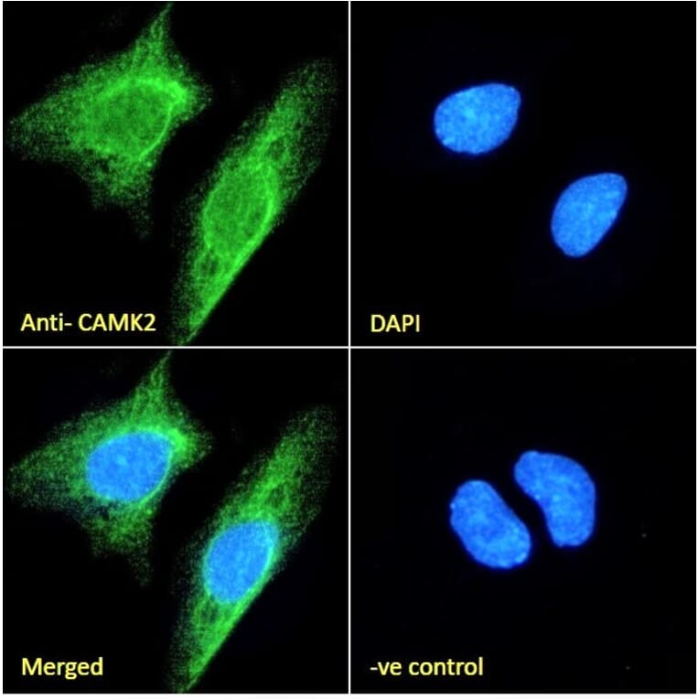 Immunofluorescence - Anti-CAMK2 alpha Antibody (A82795) - Antibodies.com