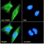 Immunofluorescence - Anti-CAMK2 alpha Antibody (A82795) - Antibodies.com