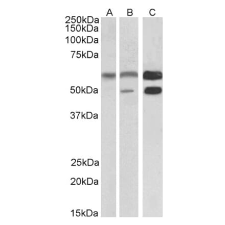 Western Blot - Anti-CAMK2A Antibody (A82795) - Antibodies.com