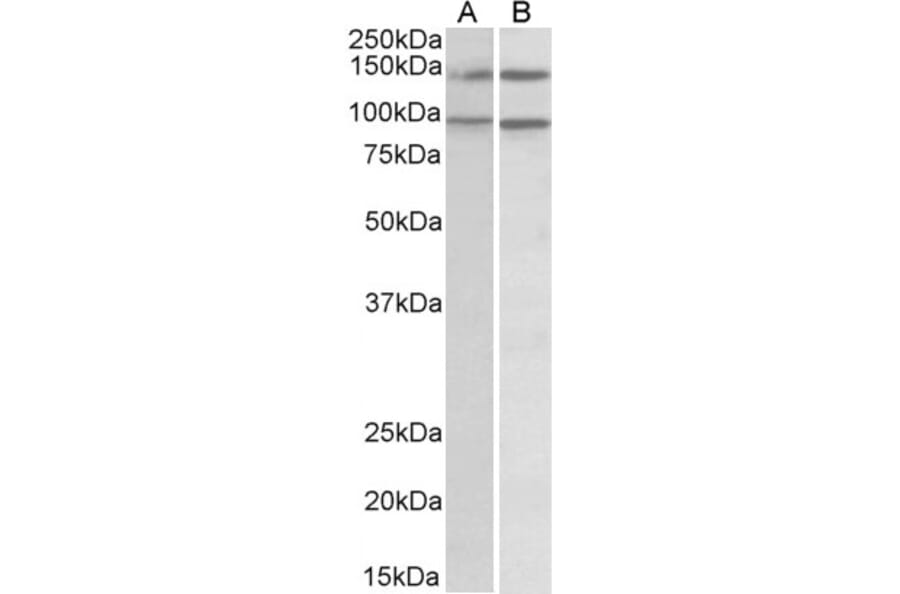 Western Blot - Anti-p114RhoGEF Antibody (A82796) - Antibodies.com